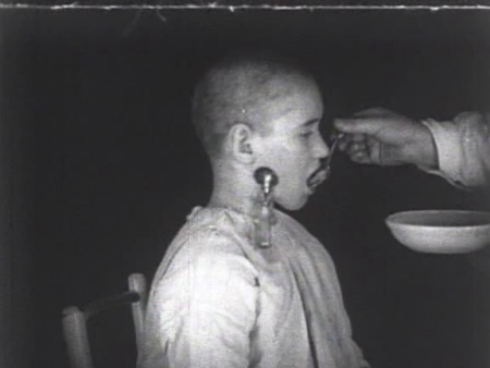 A still shot from "Mechanics of the Brain," a 1926 Soviet documentary film about Pavlovian "conditioning." The child in this picture has been surgically implanted with a saliva-catching apparatus for the purposes of behavioral experimentation.